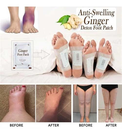 Kinoki Cleansing Toxins Remover Detox Foot Pads for Men and Women ( 10 pads )