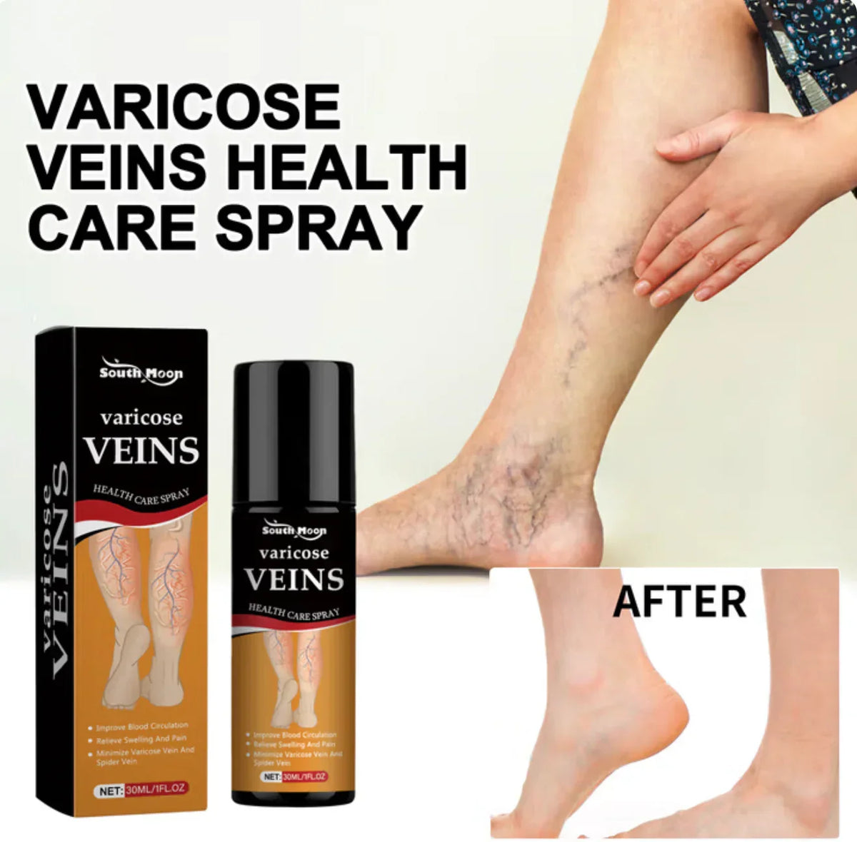 Turmeric Varicose Relief Spray