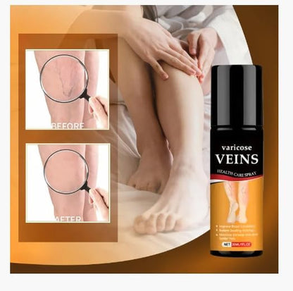 Turmeric Varicose Relief Spray