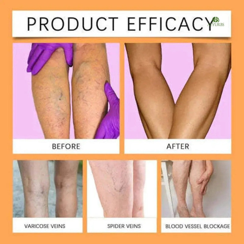 Turmeric Varicose Relief Spray