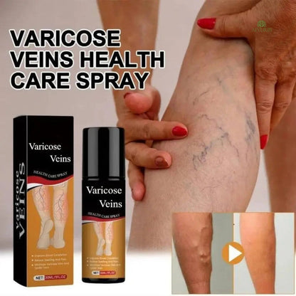 Turmeric Varicose Relief Spray