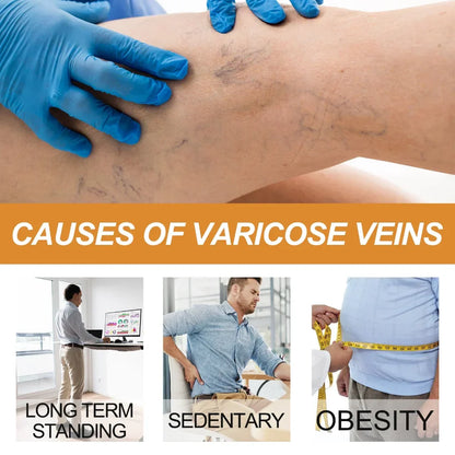 Turmeric Varicose Relief Spray