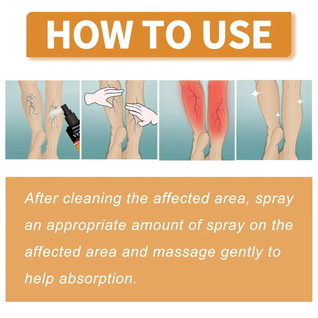 Turmeric Varicose Relief Spray
