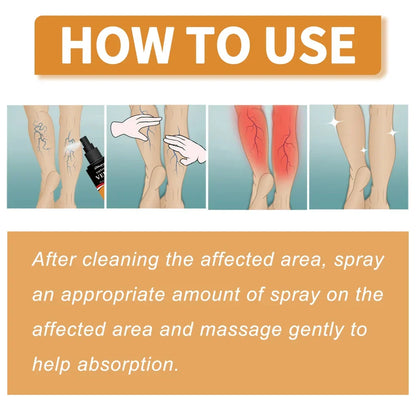 Turmeric Varicose Relief Spray